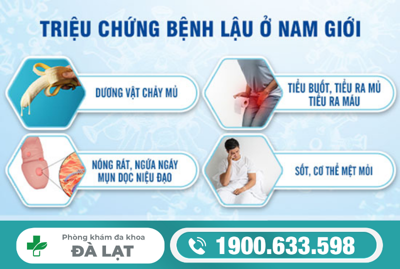 Hình ảnh minh họa